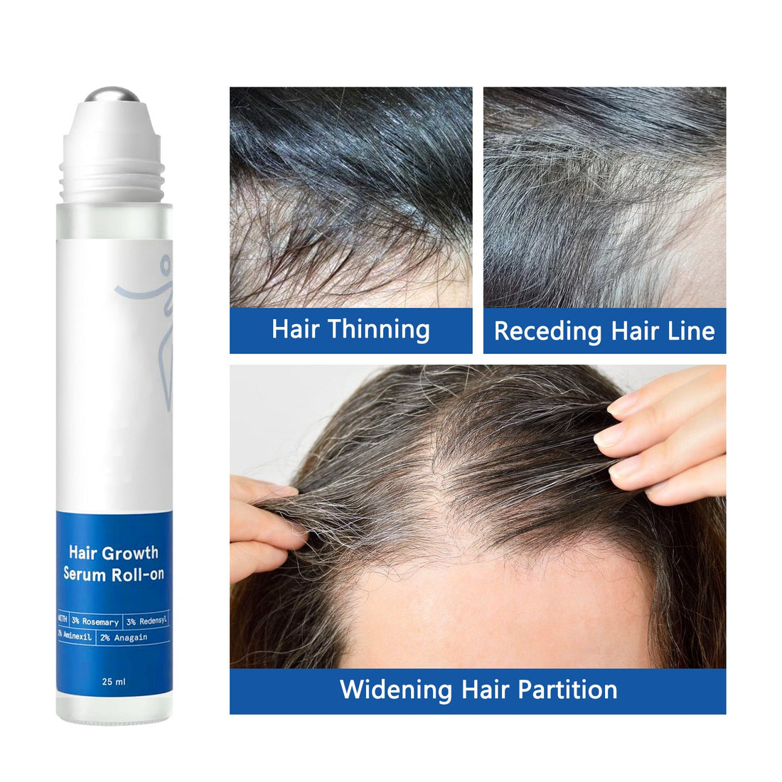 Hair Growth Serum in a white cylindrical roll-on bottle with silver roller tip, blue labels, and 25 ml marking