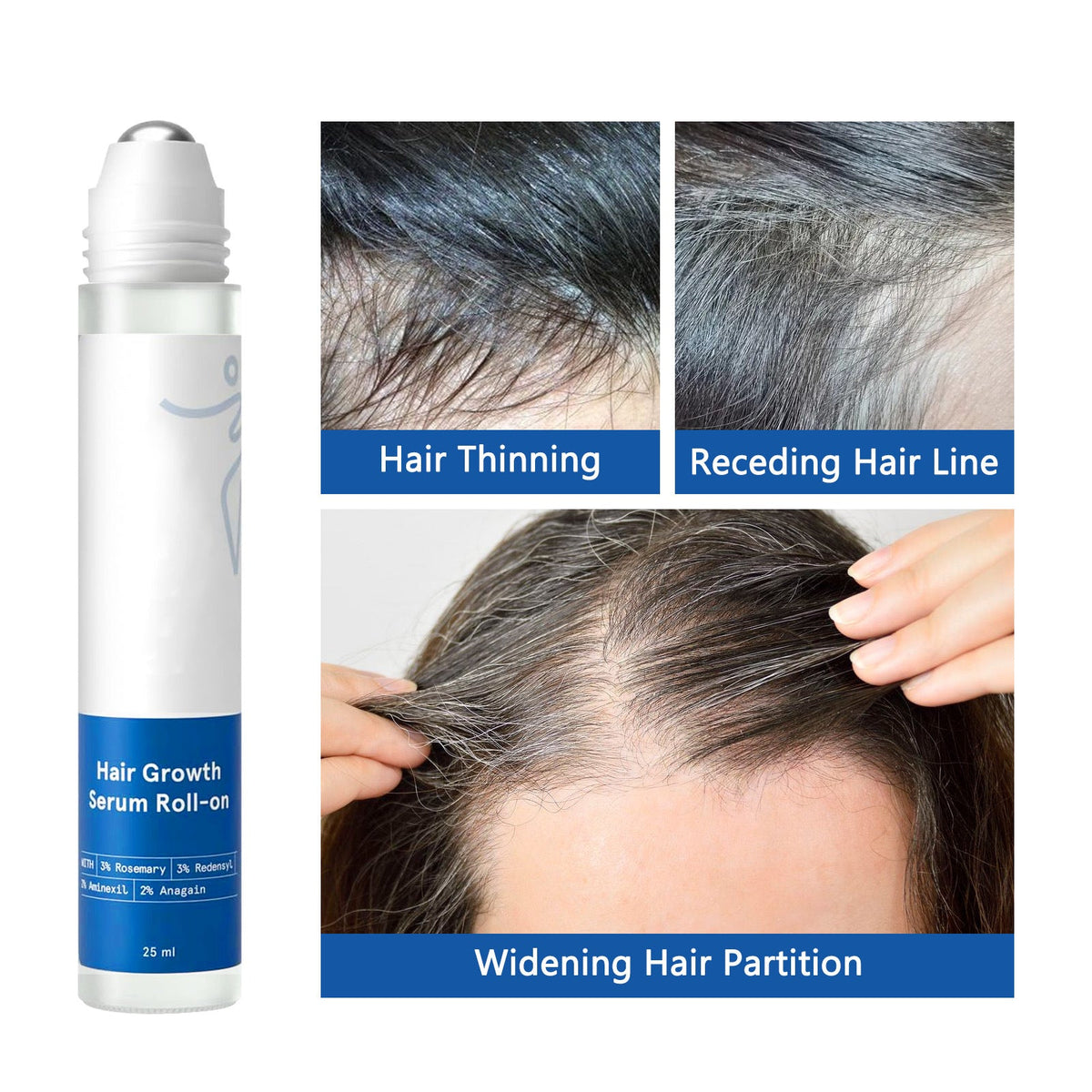 Hair Growth Serum in a white cylindrical roll-on bottle with silver roller tip, blue labels, and 25 ml marking