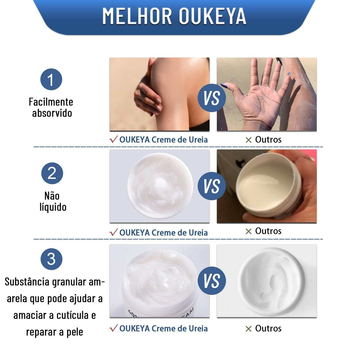 Urea Cream for Hands and Feet shown in cream-white jars with smooth, non-liquid texture and a granular appearance